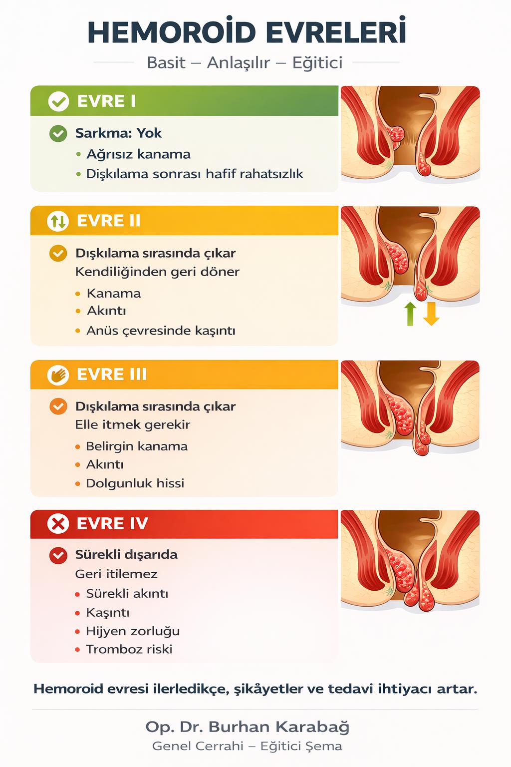 hemoroid-hastaliginda-tedavi-yontemleri